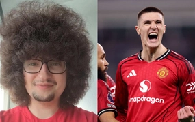 A famous MU fan is far from getting a haircut!