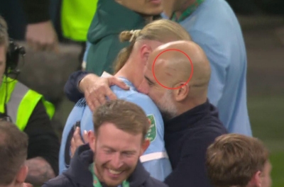 Pep Guardiola once again appears with scratches on his head